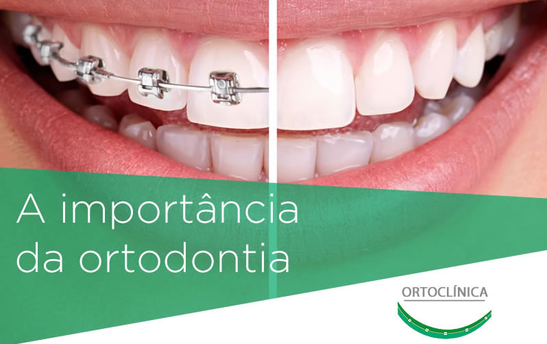 Importancia da Ortodontia